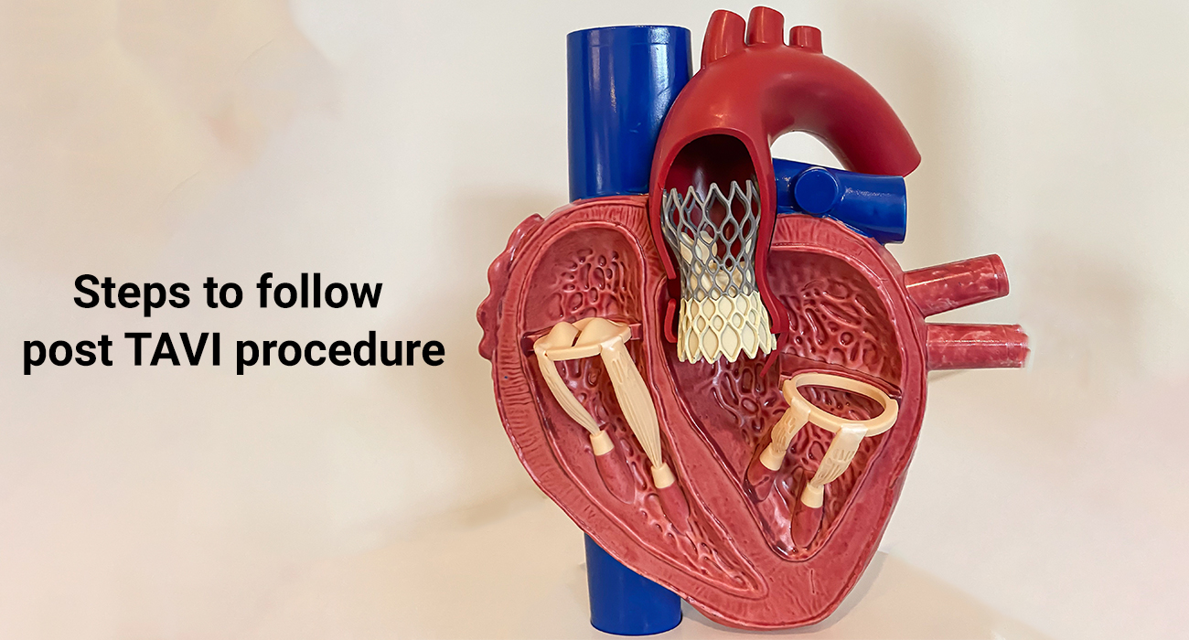 Steps to follow post TAVI procedure